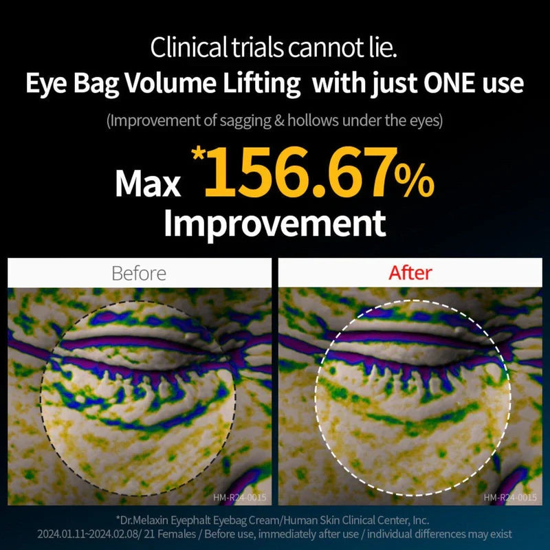 Dr Melaxin - Eyephalt Eyecream (FREE SHIPPING)