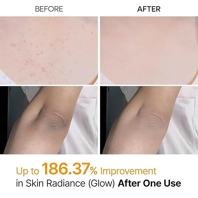 Dr. Melaxin Kojic Acid Peel Spray (FREE SHIPPING)